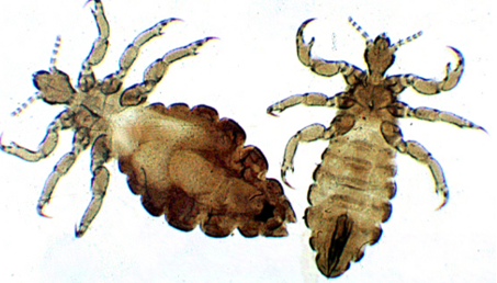 <p><strong>poux de tête</strong> - insecte</p><p></p><p>abdomen développé, oeuf = lentes blanches, aux racines</p><p></p><p>TTT : diméticone = pouxit</p>