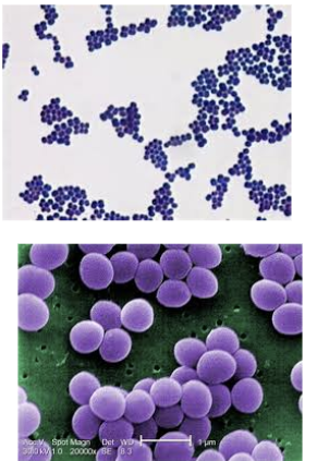 <p>Infection type in <strong>Staphylococcus aureus</strong></p>