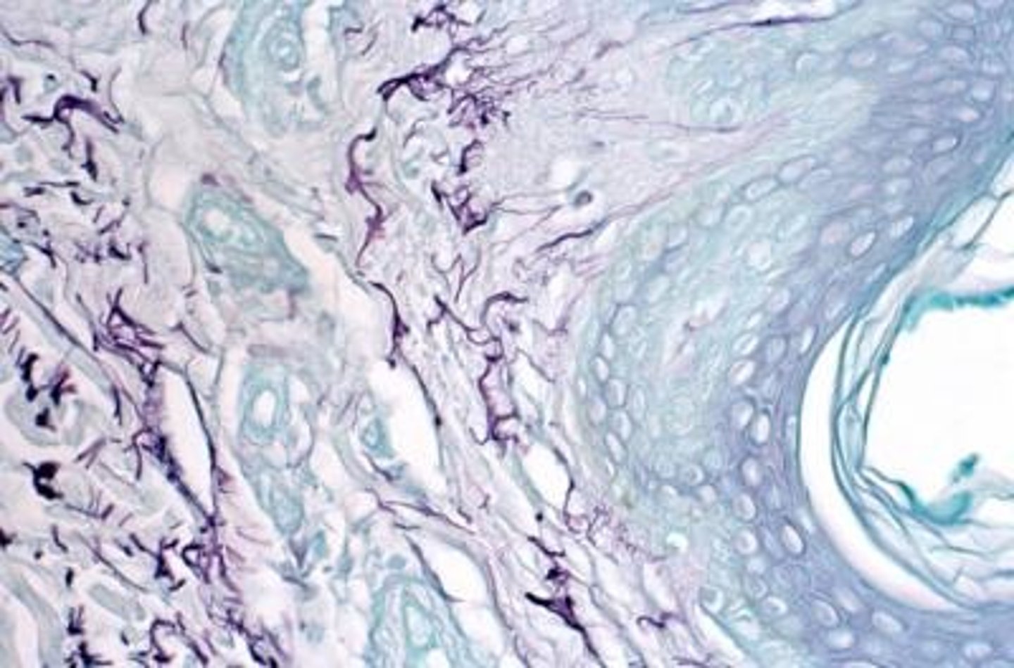 <p>elastic and mast cells</p>