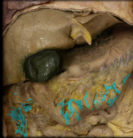 <p>hanging from the haustra are folds of peritoneum filled with adipose tissue</p>