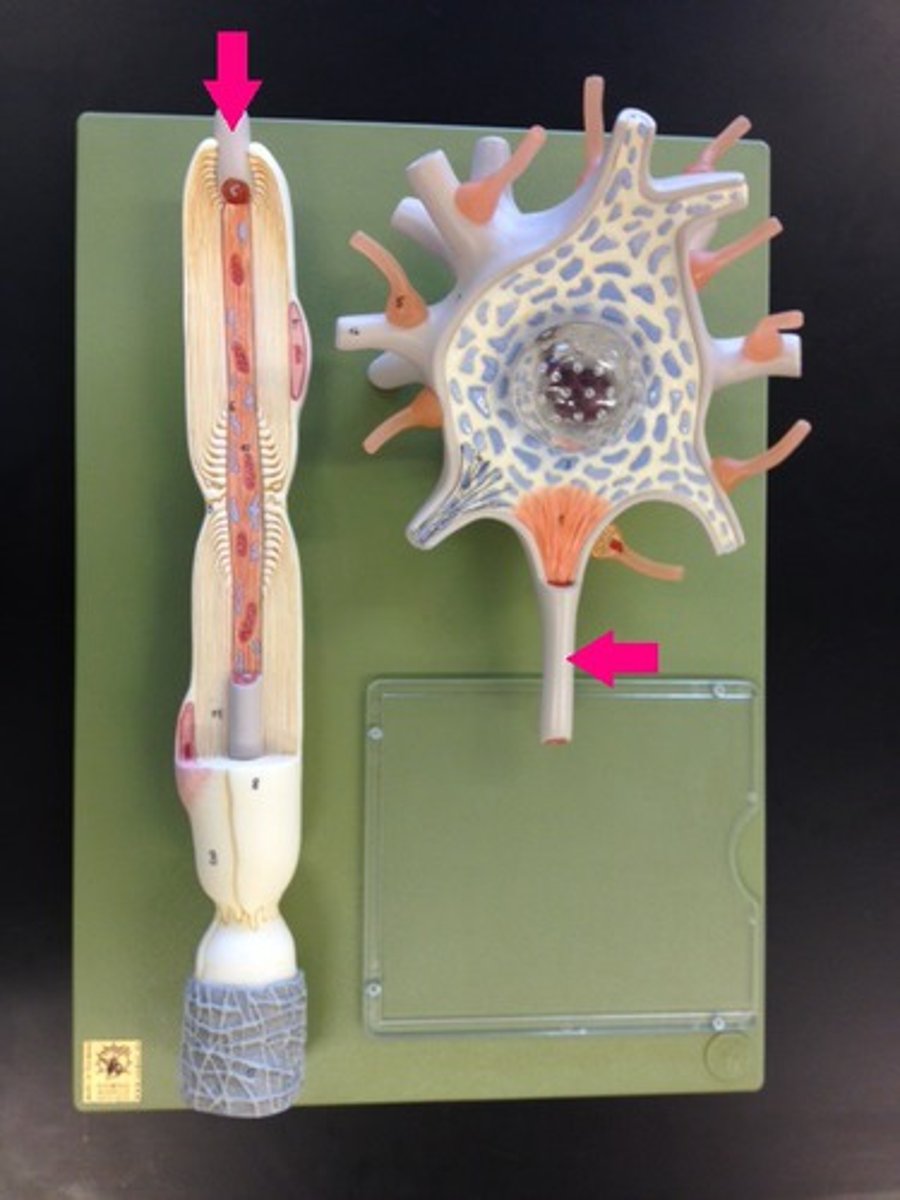 <p>Identify the structure.</p>