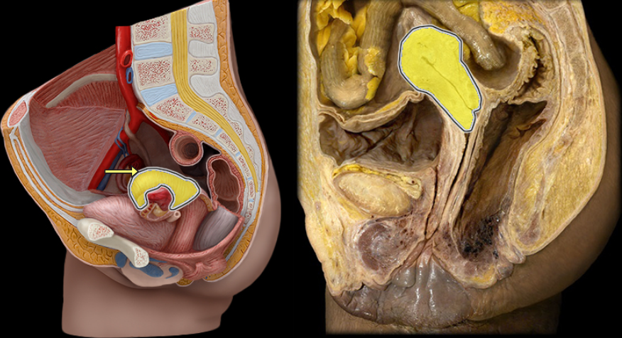 <p>what part of the female pelvis is this</p>