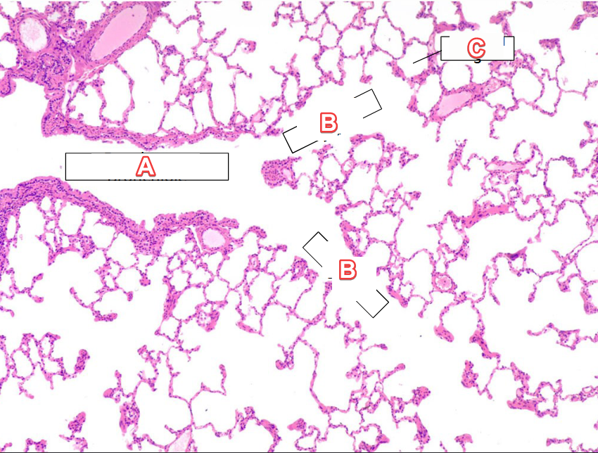 <p>The picture is a histology slide of the…</p>