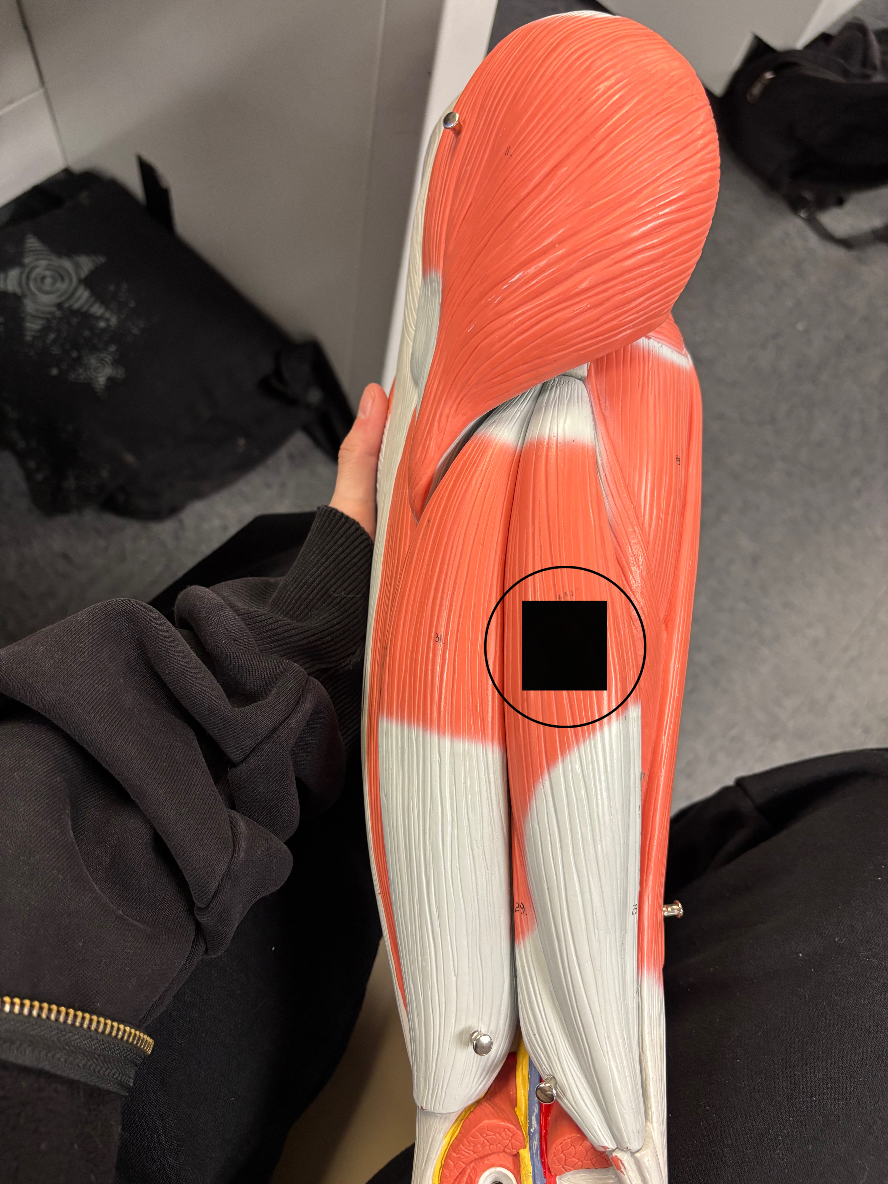 <p>What muscle is this and what is its action?</p>