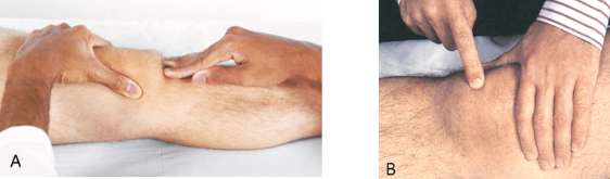 <p>Ballottement of Patella</p>