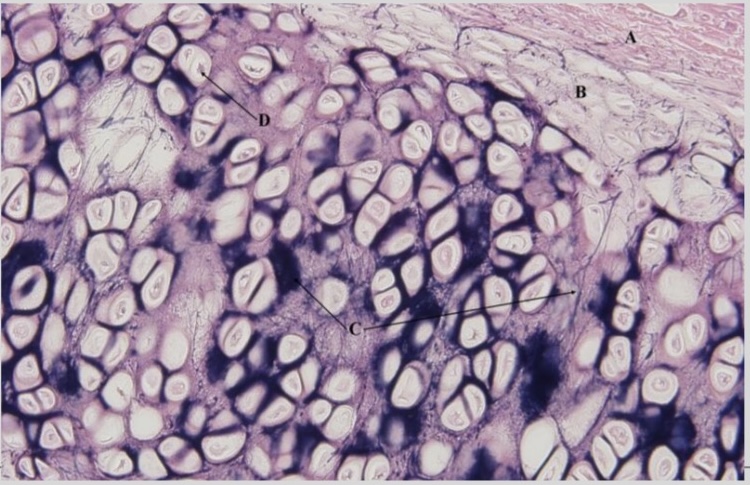 <p>NTK: what type of cartilage is this </p>