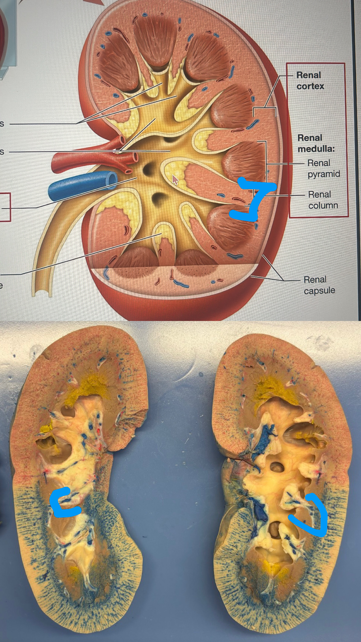<p>renal medulla</p>
