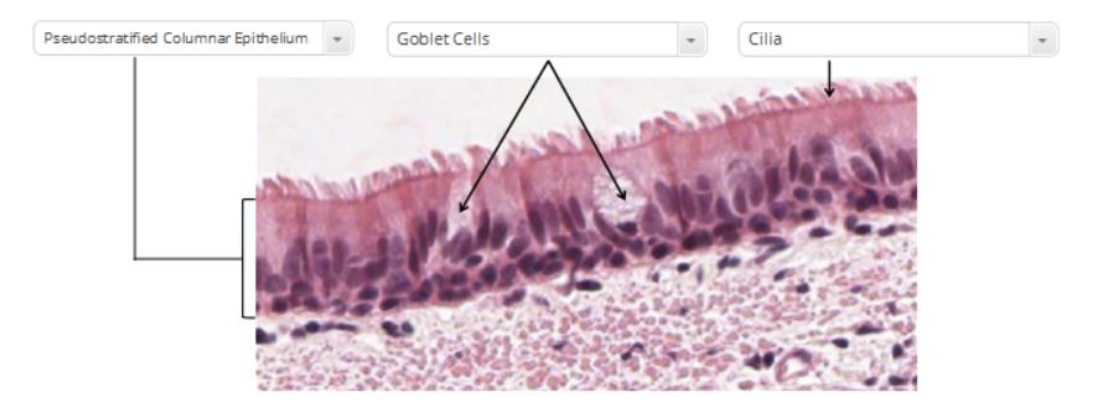 <p>respiratory tract epithelium </p>