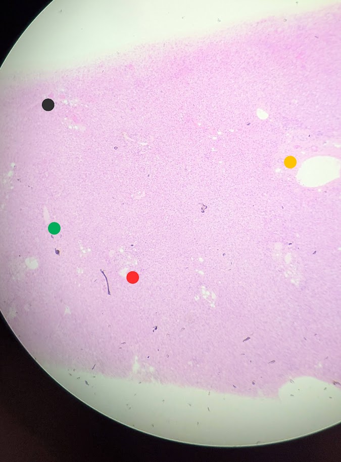 <p>Where in the body is this</p>