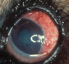 <p>Hyphema & keratic precipitates</p>