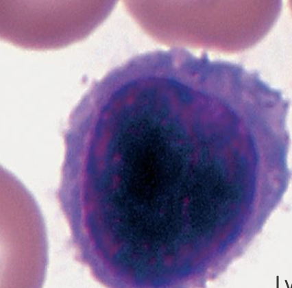 <p>What type of Leukocyte</p>