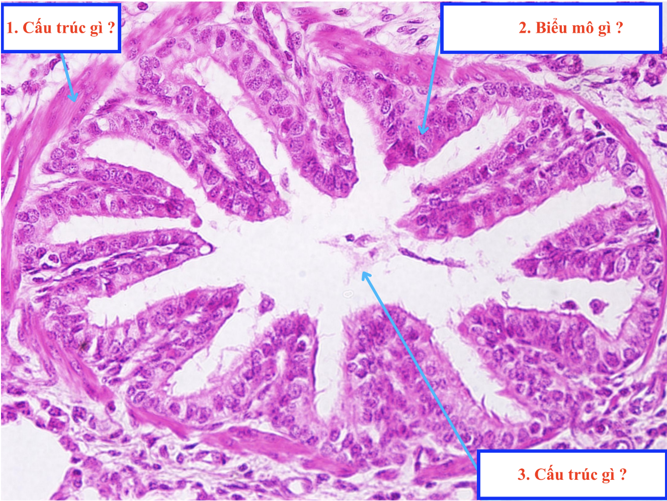 <ol><li><p>Cấu trúc gì ?</p></li><li><p>Biểu mô gì ?</p></li><li><p>Cấu trúc gì ?</p></li></ol><p></p>