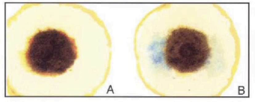 <p>color of positive result</p>