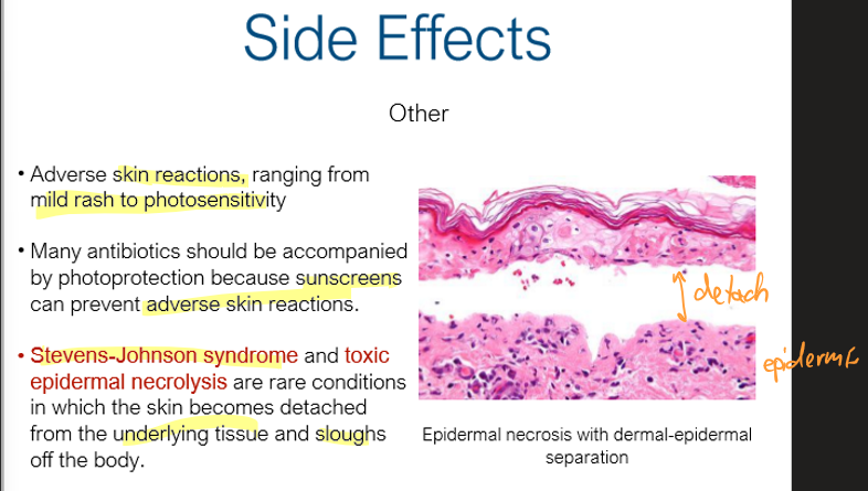 <p>when skin become detached from underlying tissue</p>