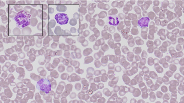 <ol><li><p><strong>Neutrophils</strong></p></li><li><p><strong>Eosinophils</strong></p></li><li><p><strong>Basophils</strong></p></li><li><p><strong>Lymphocytes</strong></p></li><li><p><strong>Monocytes</strong></p></li></ol><p></p>