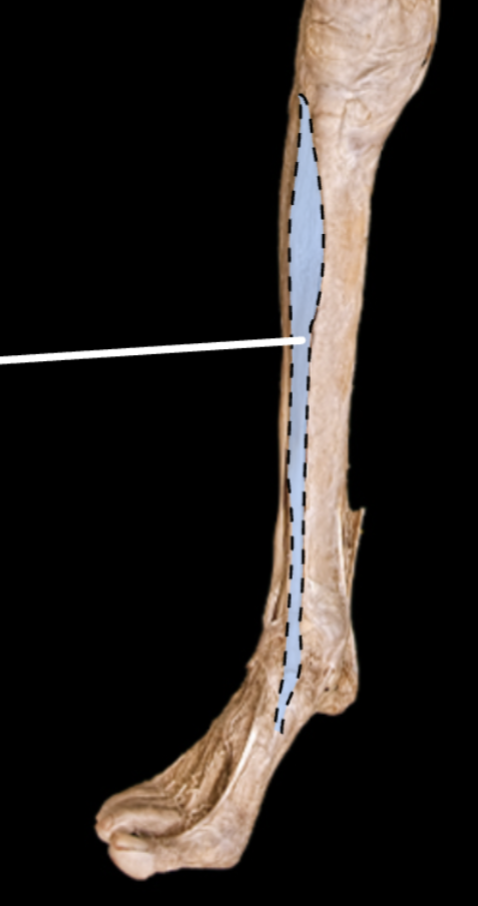 <p>Origin: Lateral condyle and upper ½ of the tibial shaft</p><p>Insertion: inferior surface of medial cuneiform and first metatarsal bone</p><p>Action: Dorsiflexion (primary) &amp; inversion of the ankle (secondary)</p><p>Innervation: Deep Fibular Nerve</p>