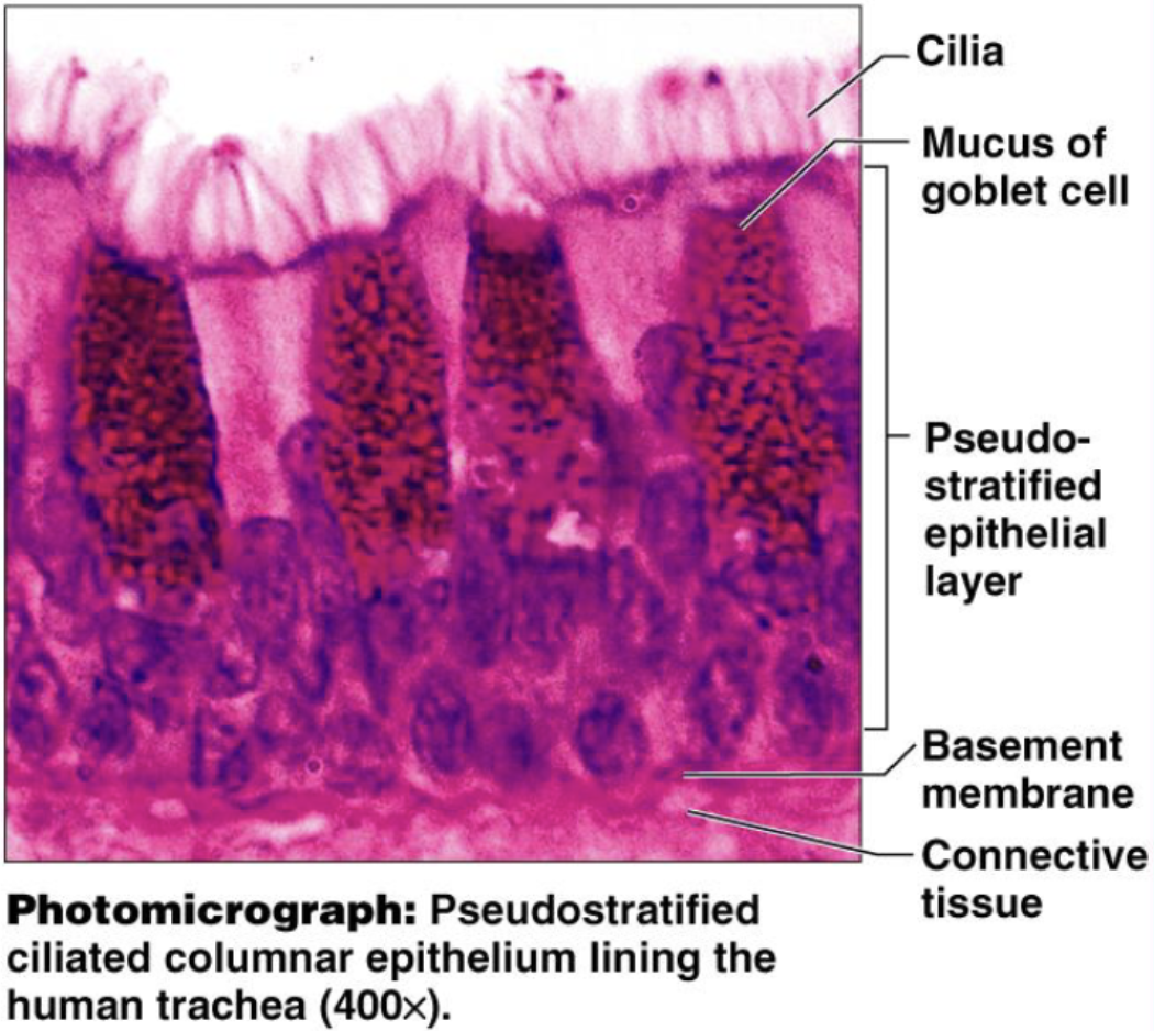 <p>Pic: trachea </p><p>Male sperm-carrying ducts (nonciliated) and trachea (ciliated)</p>