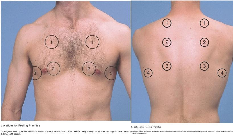 <ul><li><p>Tactile Fremitus - Instruct Pt to say ‘99’ in each of these areas. Feeling for any increased vibration (excess tissue ie. mass or consolidation) or decreased vibration (Excess air ie. asthma/emphysema)</p></li></ul><p></p>