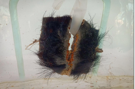 <p>Questions</p><ol><li><p>What is the specimen being examined?</p></li><li><p>What are the descriptive features of the injury on the scalp?</p></li><li><p>What is the likely causative instrument for this type of injury?</p></li><li><p>How is the time of death estimated in relation to the injury?</p></li><li><p>What are the possible causes of death?</p></li><li><p>What is the final diagnosis for this specimen?</p></li></ol><div data-type="horizontalRule"><hr></div><p></p>