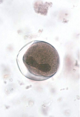 <ul><li><p>cyst </p></li><li><p>causes balantidiasis </p></li></ul><p></p>