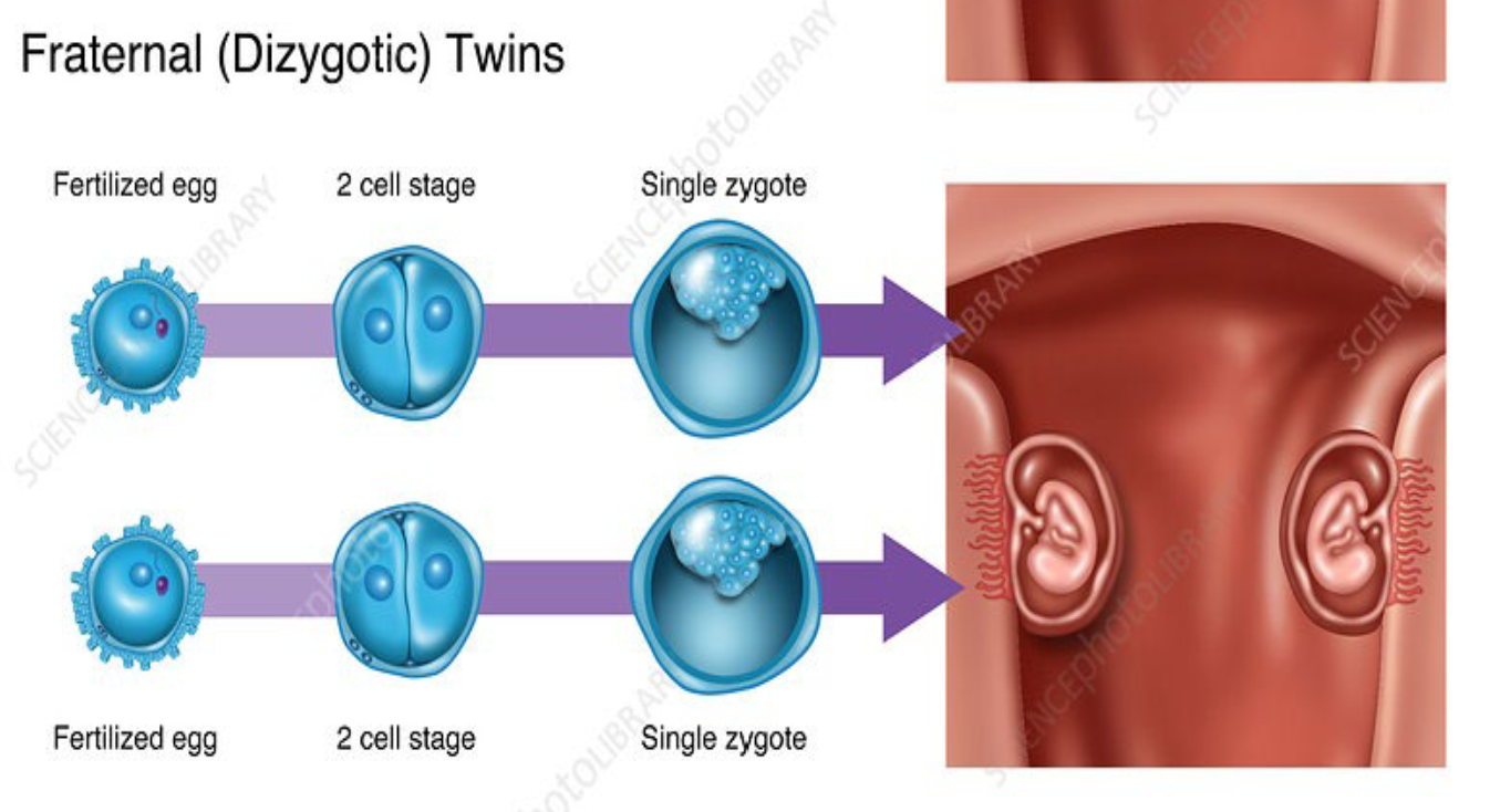 <p>Dizygotic (fraternal) twins = 2 separately</p><p>fertilized eggs</p><p>• Not genetically identical</p>