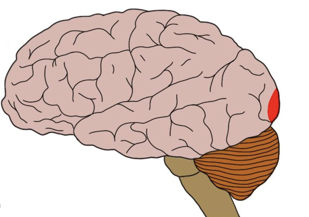 term image
