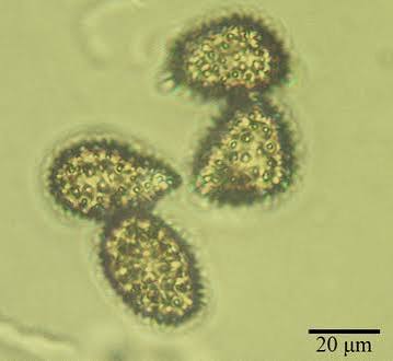 <p>having short projections on the surface of spores</p>