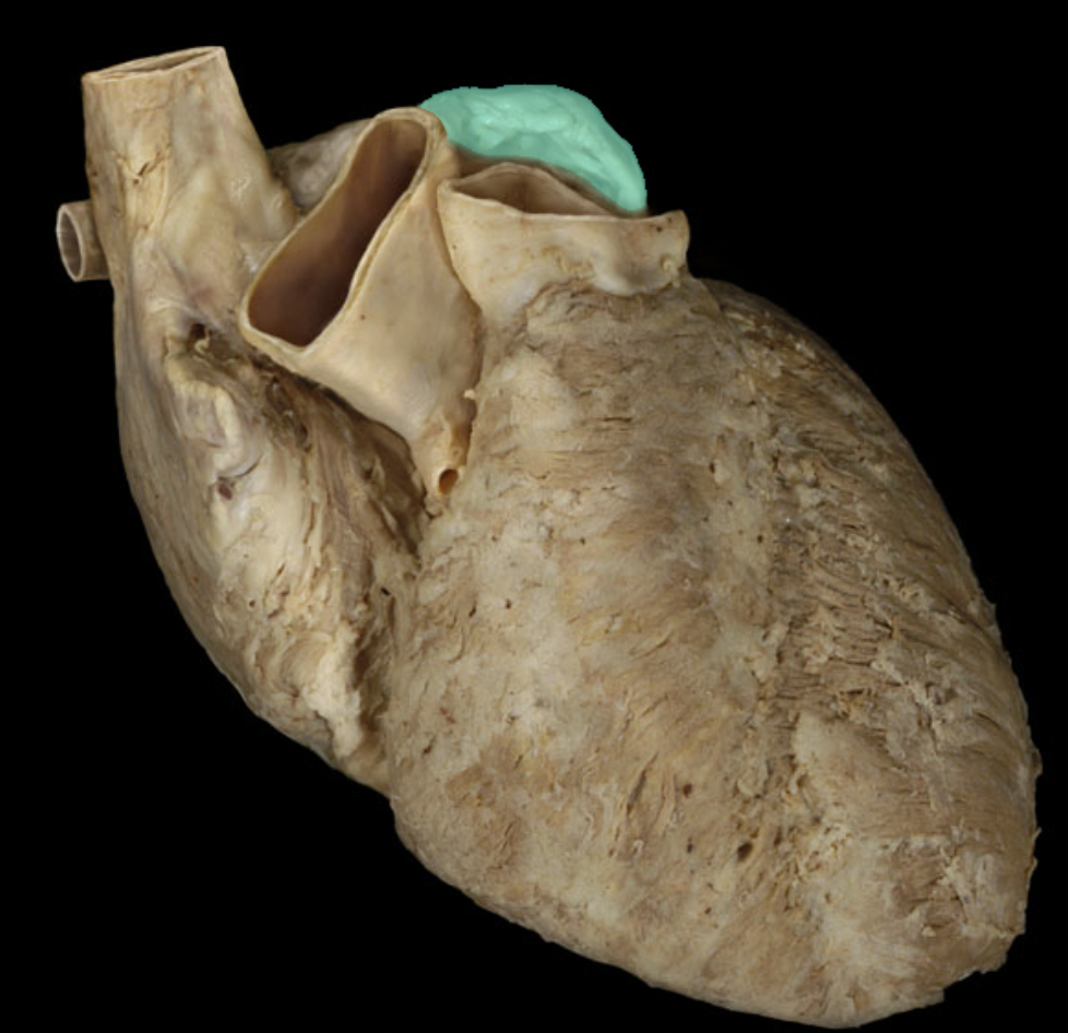 <p>Left auricle</p>