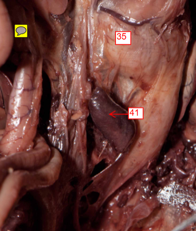 <p>41</p>