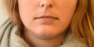 <p>Jaw Drop</p>