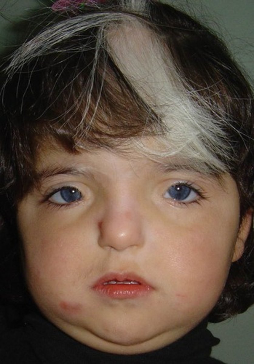 <p>wide spaced eyes</p>