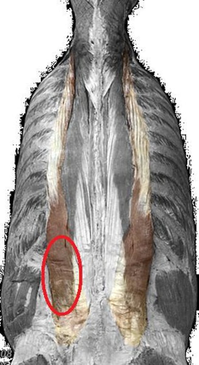 <p>angles of lower 6 ribs</p>