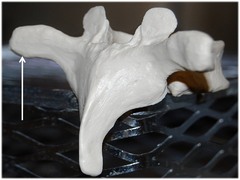 <p>Name this specific part of the thoracic vertebra.</p>