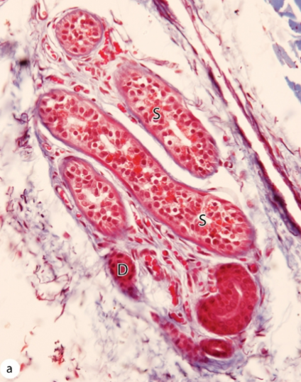 <p>Name the image and the shape of the lumen</p>