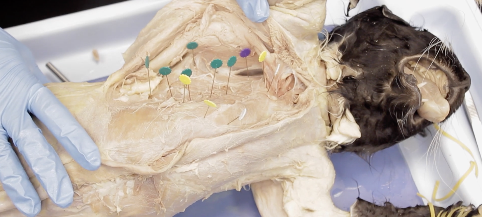 <p>What muscle is pinned in green?</p>