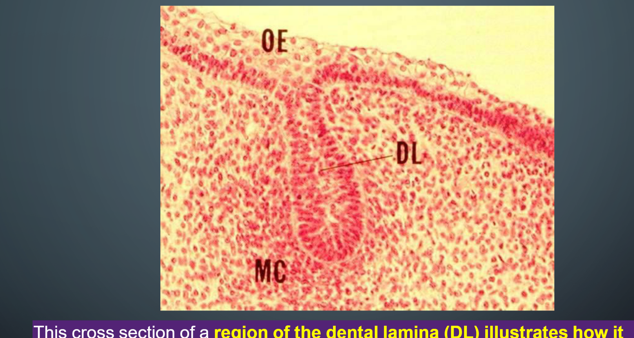 <ul><li><p>Parts of the dental lamina will develop into teeth.</p></li><li><p>The dental lamina is surrounded by a condensation of ectomesenchymal cells (MC) that will become the dental papilla and dental follicle</p></li></ul><p></p>