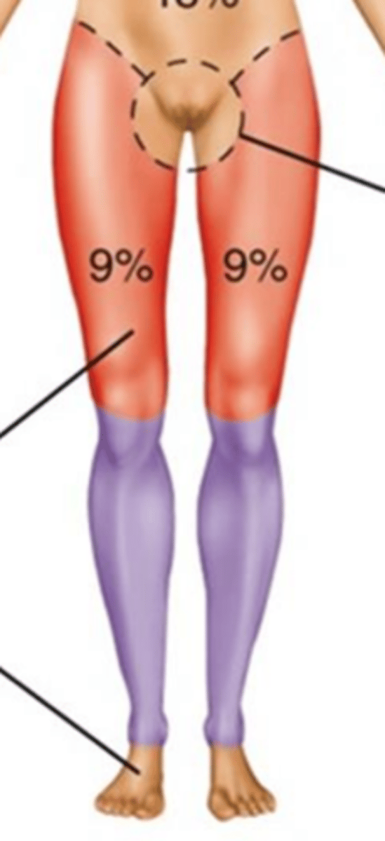 <p>36%</p>