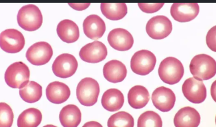 <p>what type of erythrocyte cell is this?</p>