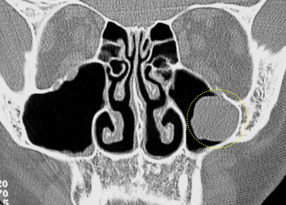 term image