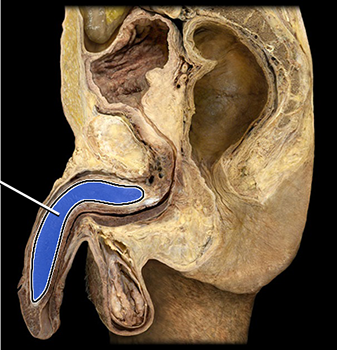 <p>what structure is highlighted?</p>