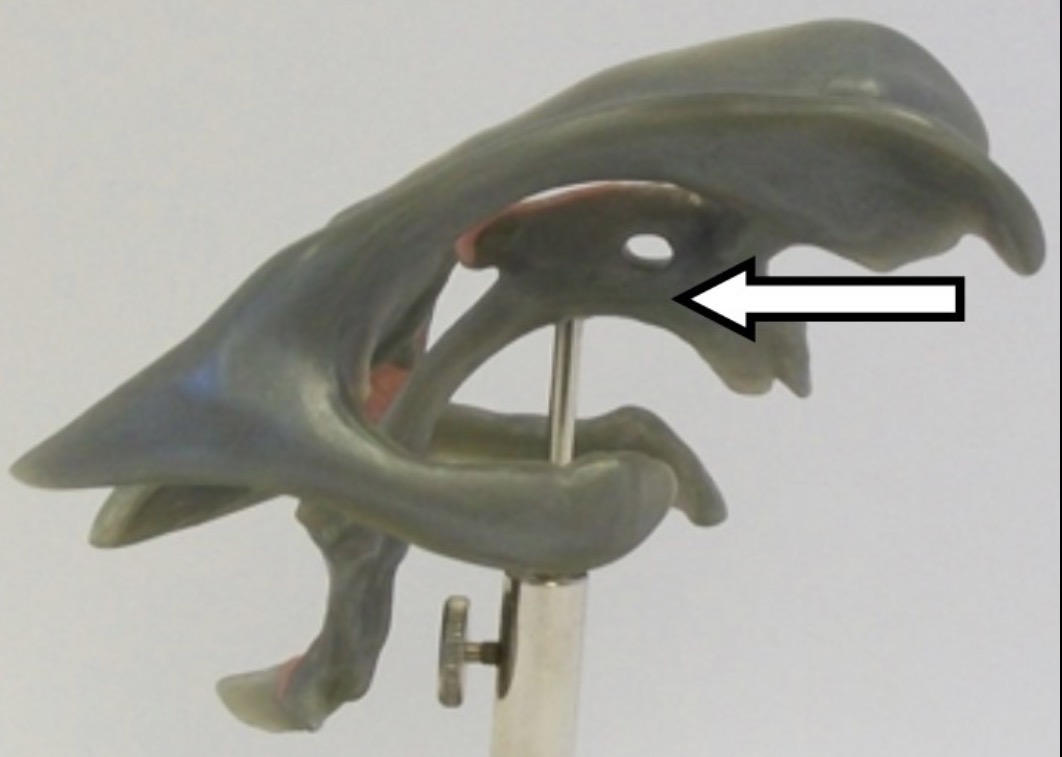 <p>What is the arrow pointing to?</p>