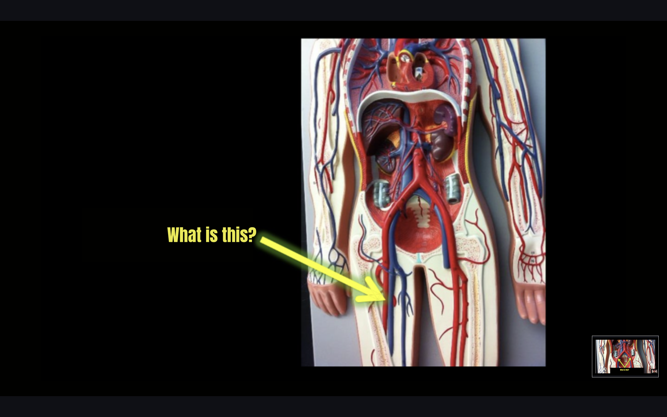 term image
