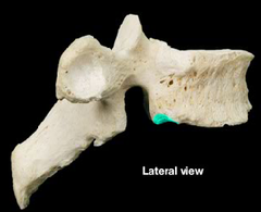 <p>*on thoracic vertebrae*</p>