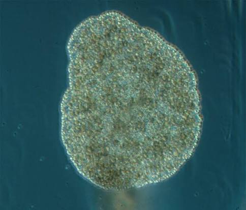<p>placoza</p>