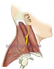 <p>spinal accessory</p>