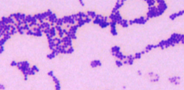 <p>What morphology?</p>