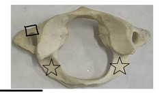 <p>what is marked? (not the star)</p>