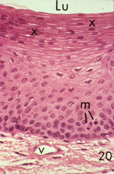 <p><span style="line-height: 21.6px;">Transitional epithelium</span></p>
