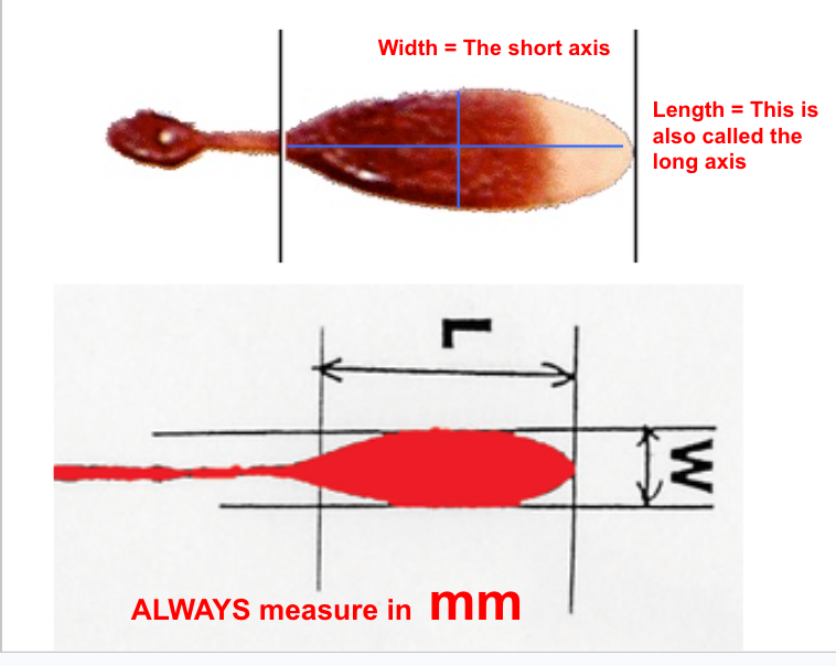 <p><span style="background-color: transparent;"><strong>Length must always be greater than width or you will get an undefined answer on the calculator!</strong></span></p>