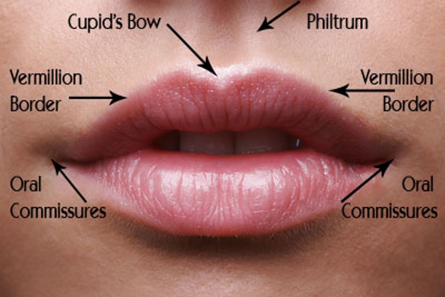 <p>the rim of paler skin that demarcates the vermilion from the surrounding skin</p>